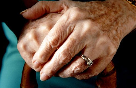 alzheimers - Mental Health News