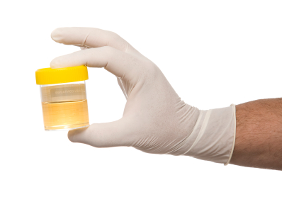 Urine Sample - Mental Health News